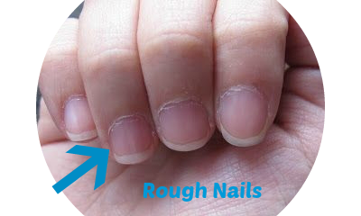ragged-finger-nails-rough-nails-cuticles
