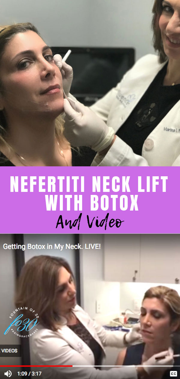 Nefertiti Neck Lift With Botox