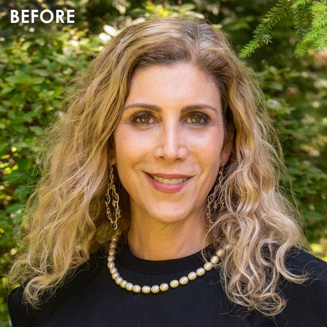 before ultherapy lauren dimet waters before ultherapy lauren dimet waters fountainof30