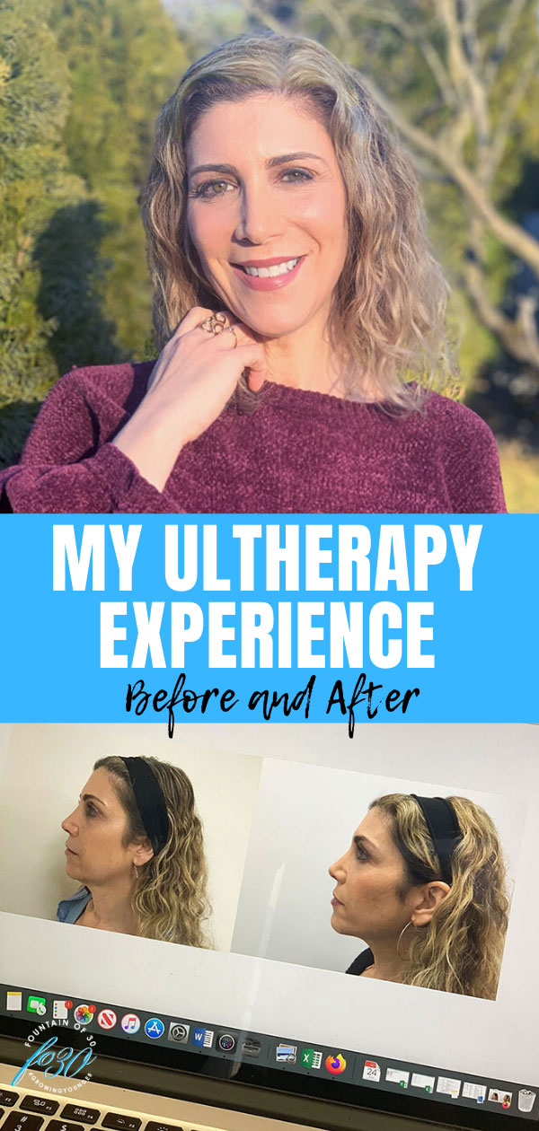 ultherapy experience before and after fountainof30