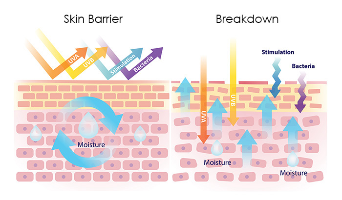 skin barrier breakdown fountainof30