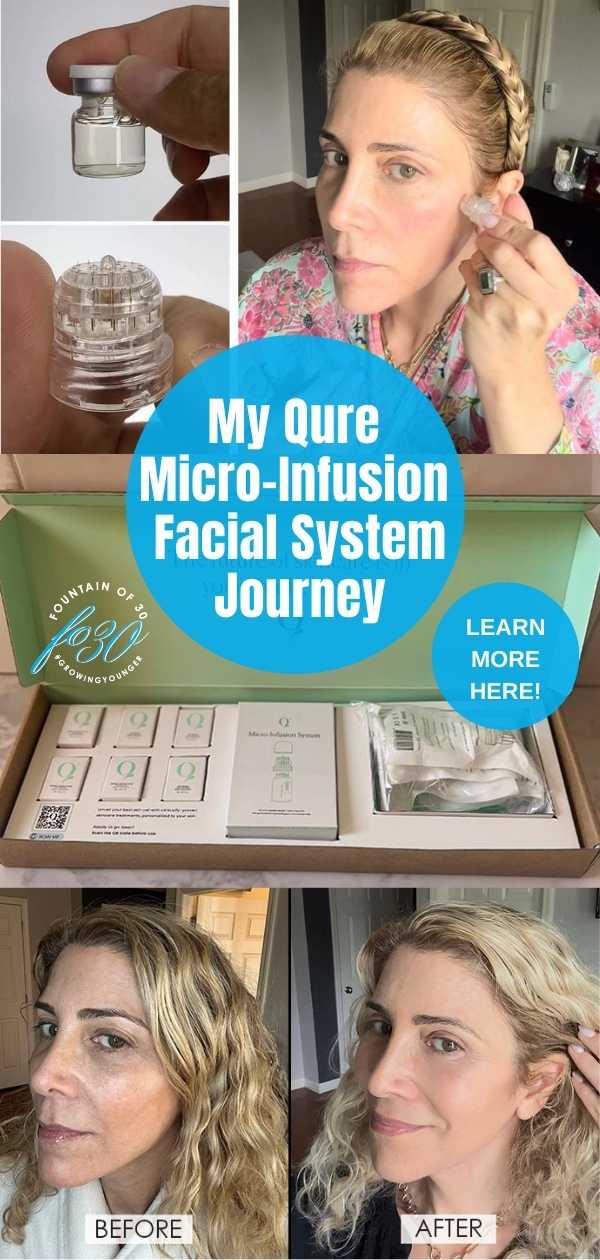 qure micro-infusion facial system journey before after fountainof30