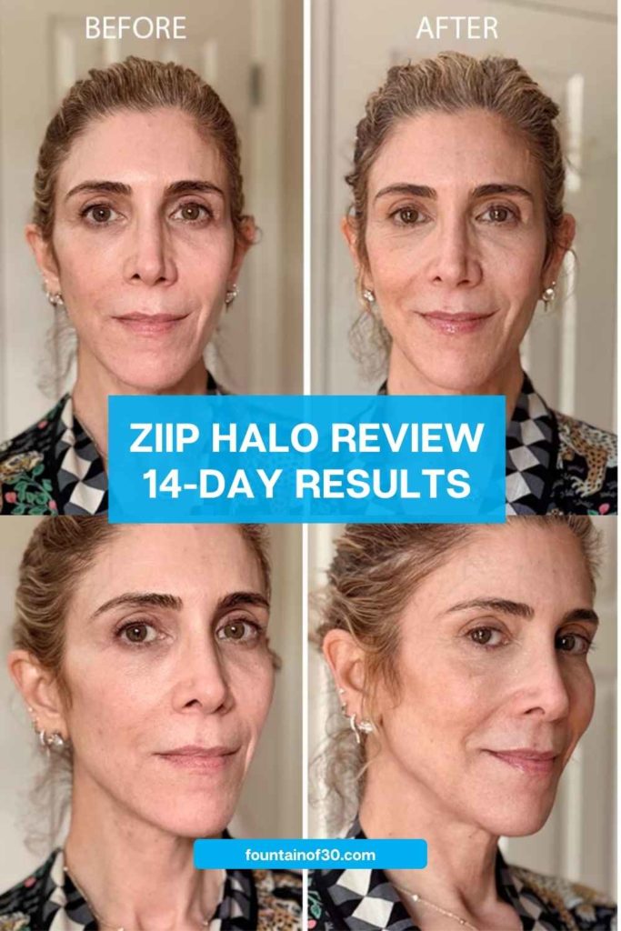 ZIIP HALO Review: My Honest 14-Day Before & After Results fountainof30